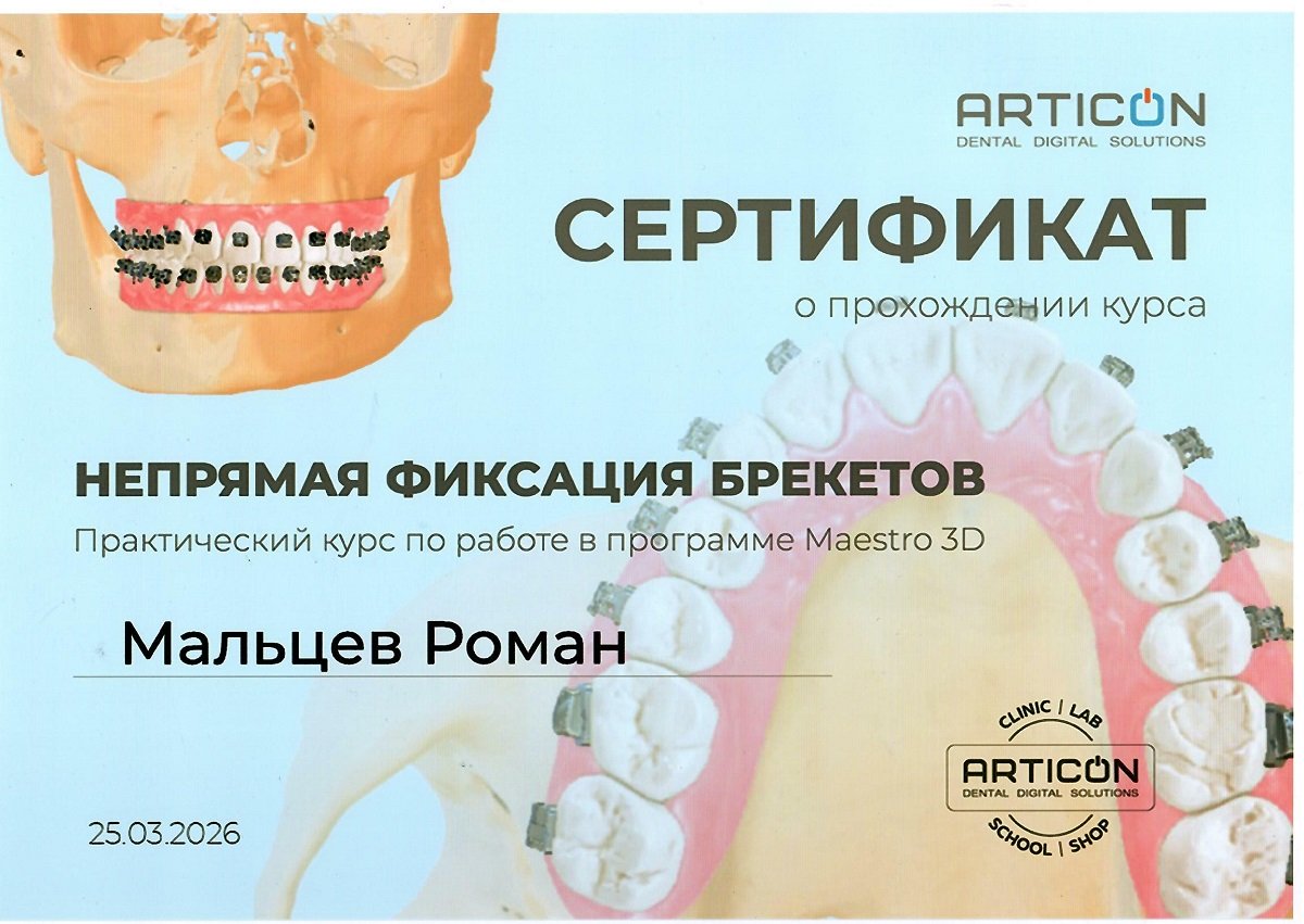 Непрямая фиксация брекетов. Практический курс по работе в программе Maestro 3D